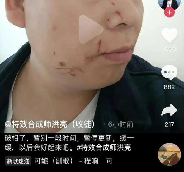 迪丽热巴？男网红称因合成与女星接吻视频被打
