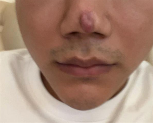 小伙在整形后称没法靠颜值吃饭了