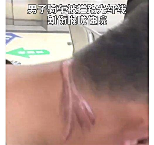男子骑车被光纤拦路割喉