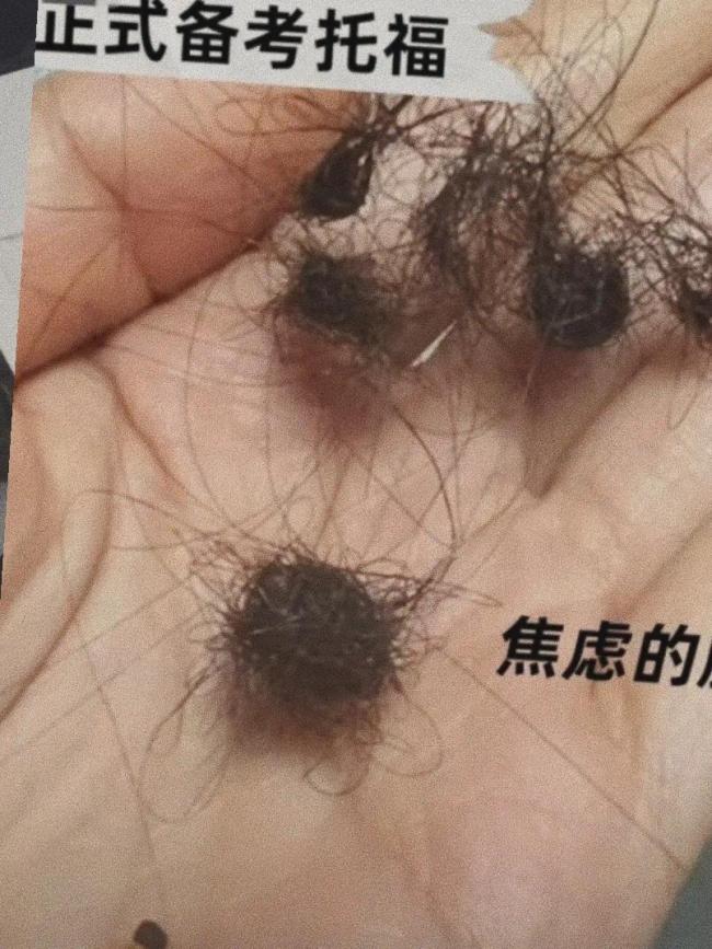 张静初晒自己录取通知书 娱乐圈也开始内卷了？