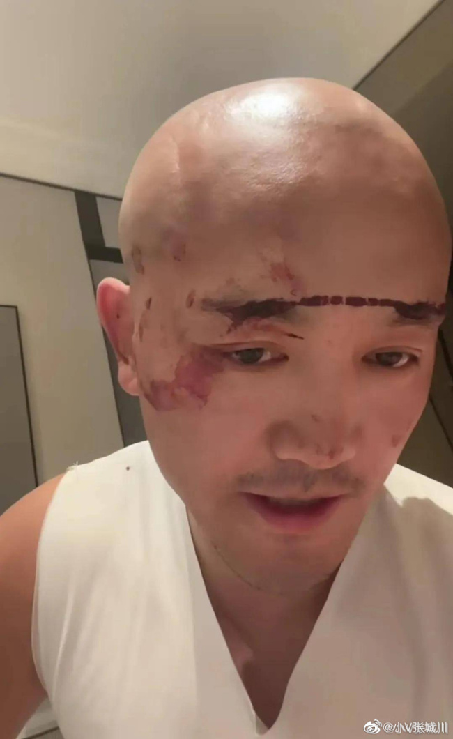啥情况？！网红武僧一龙称被偷袭打伤