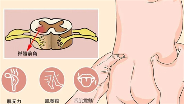 患者类型更加细化