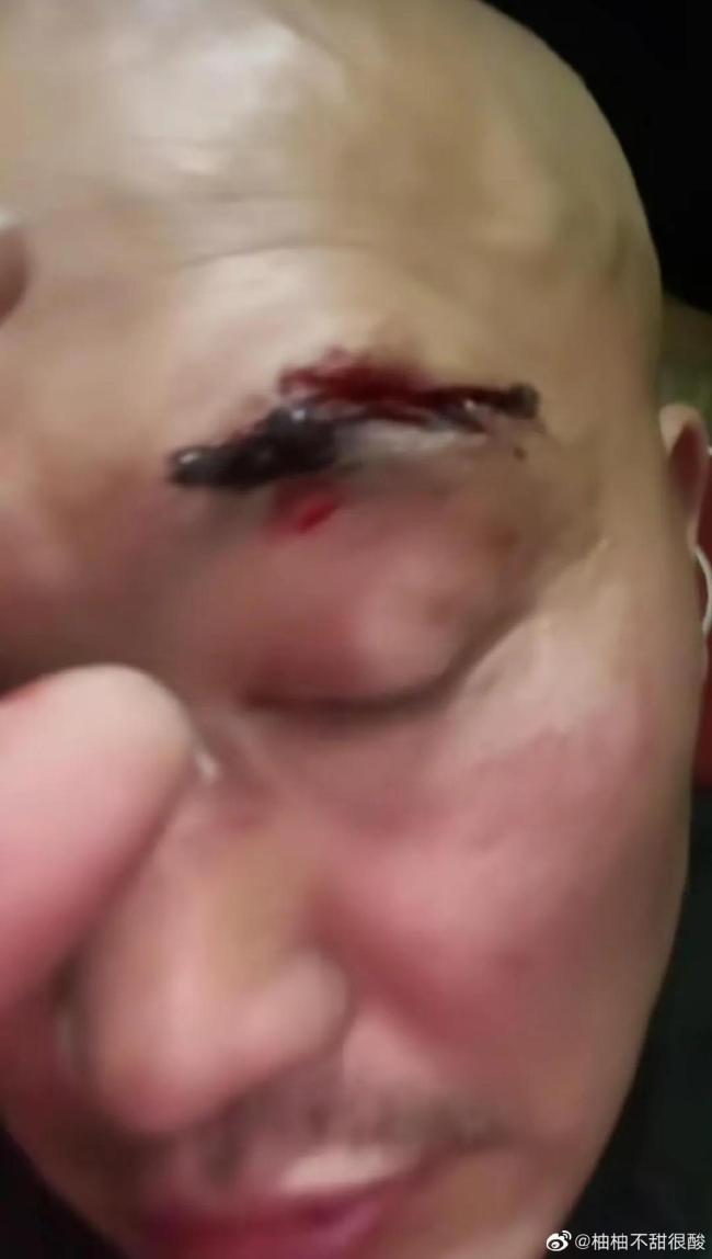 啥情况？！网红武僧一龙称被偷袭打伤