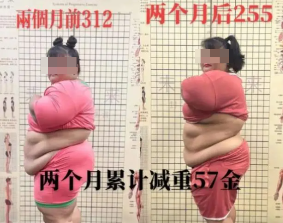 一声叹息！半年减重60斤网红猝死 年仅22岁