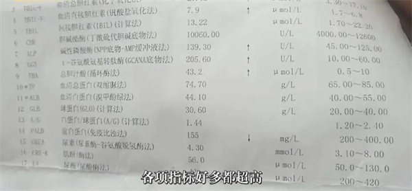 唐山男子在饭店吃到了壁虎