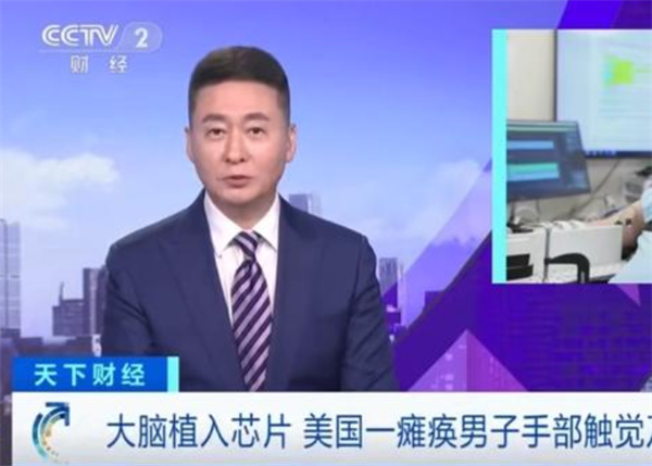 瘫痪男子植入芯片后恢复手部运动