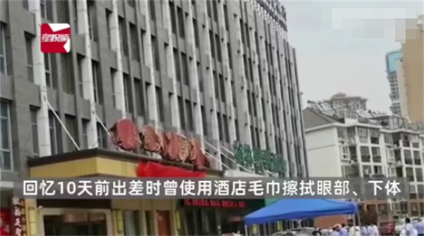 男子用酒店毛巾擦身体得淋病