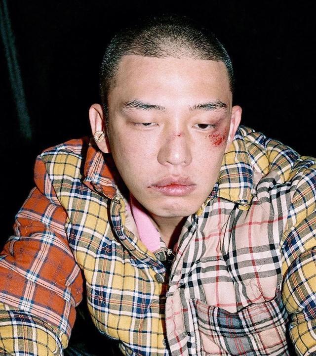 被震惊到！刘亚仁181次注射9.6升异丙酚 相当于两桶油