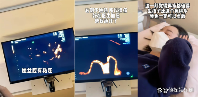 35岁张檬分享备孕艰辛历程 觉得自己做的不够好宝宝不选自己做妈妈