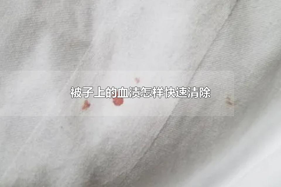 被子上的血渍怎样快速清除 被子上的干血渍怎么样除掉