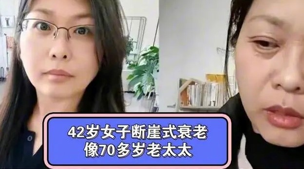 42岁女子为何会经历断崖式衰老