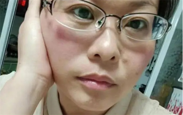 断崖式衰老女子本以为能漂亮过余生
