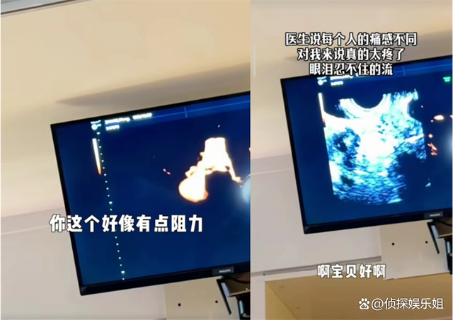 35岁张檬分享备孕艰辛历程 觉得自己做的不够好宝宝不选自己做妈妈