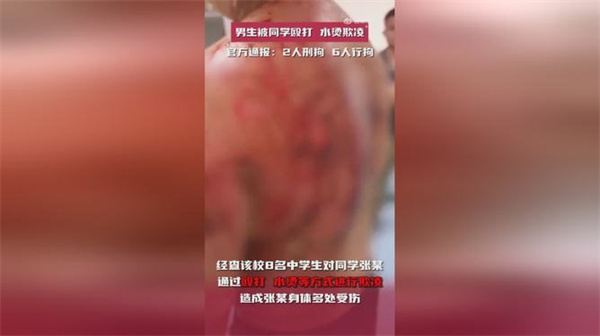 官方通报南宁学生被多人殴打水烫欺凌 涉事学生被刑拘