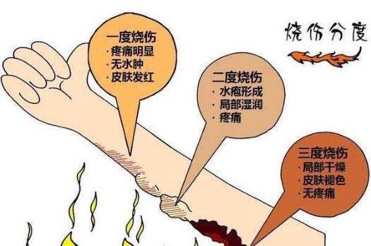 阻止继续烧伤只要18秒