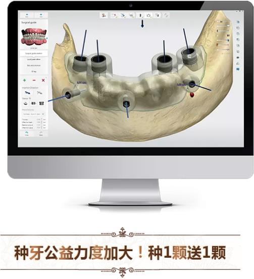 中家医口腔全民爱牙公益行动：德国智能种植牙更靠谱