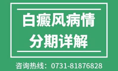 娄底白癜风医院专家病情阶段分期详解