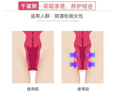 千黛斯怎么样有没有效果？牢记3点信心十足！