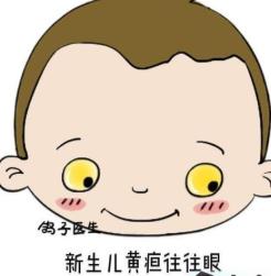 胆结石病人饮食要注意 4种食物是禁忌