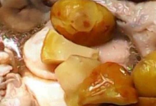 女性比男性更需要补肾 推荐2种女人能够保护肾脏的食疗方