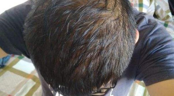 男人如果肾虚的话就会导致性能力下降 男人肾虚的6大症状