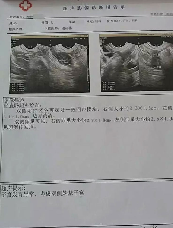 女孩20多岁无月经，在深圳港龙恢复女儿身