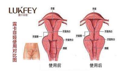 缩阴产品哪个效果好，排行榜前三供你参考！