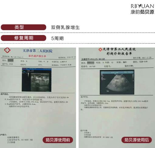 乳房胀痛怎么缓解，乳房疼痛是什么原因引起的