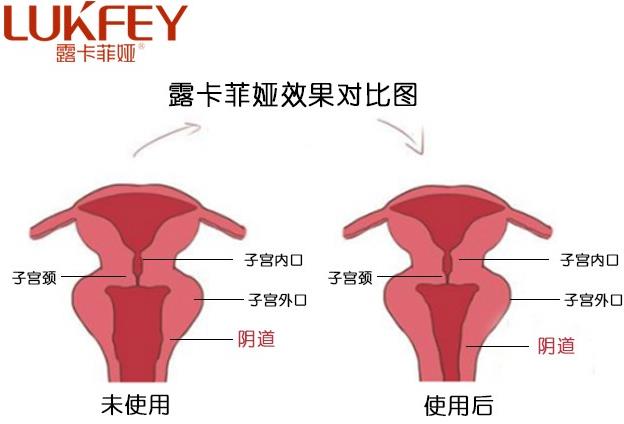 缩阴产品有副作用吗？使用者为你答疑！