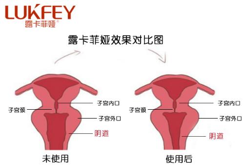 私护产品什么品牌好，首选国家最安全的私护产品