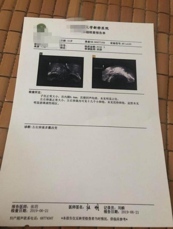 一代宗师素朴中医院治疗多囊卵巢综合征病例