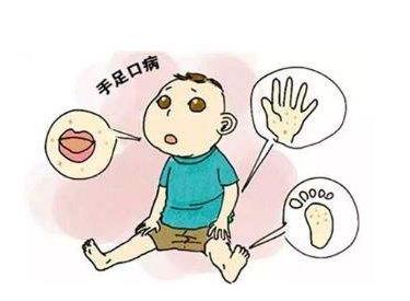 如何预防手足口病？手足口病的症状是什么