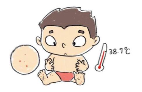 手足口病的症状是什么？手足口病不能吃什么