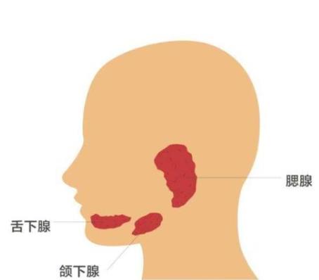 腮腺炎的症状是什么？腮腺炎不能吃什么