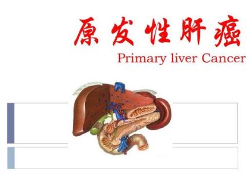 原发性肝癌不能吃什么？原发性肝癌的早期症状