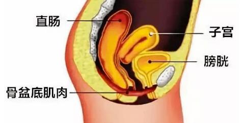 盆腔脏器脱垂的症状是什么？如何预防盆腔脏器脱垂