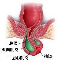 泸州东大肛肠医院收费贵吗 诚信医疗收费正规