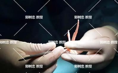 郭数忠：小耳症（五十）耳再造的条件究竟有哪些？