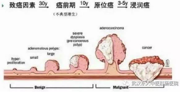 武汉东大肛肠医院：记得重视肠道检查