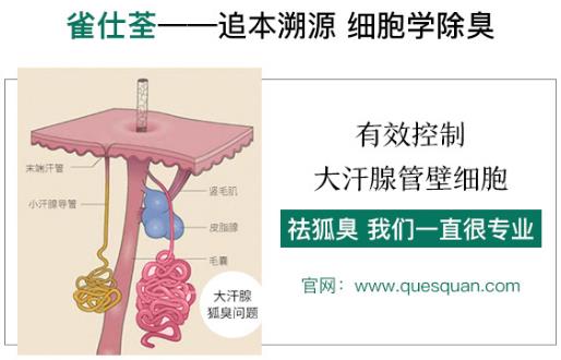 治狐臭最好的药是哪个 让您更专业的得到清香