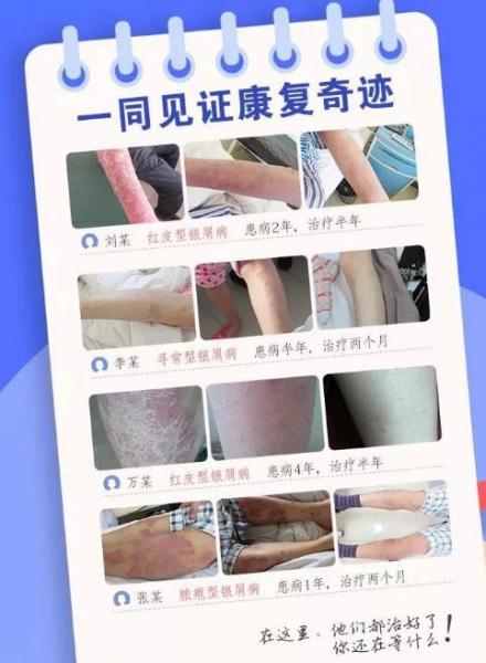 长春华山皮肤病医院诚邀葛蒙梁教授坐诊第13次联合会诊