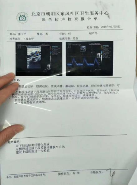 刘继前技术怎么样 动脉硬化患者在国康医院完全康复