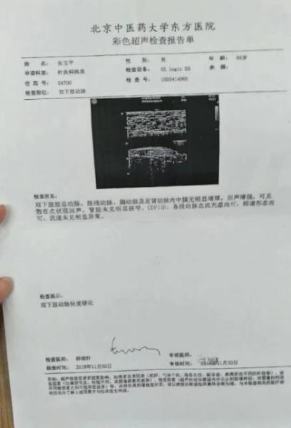 刘继前技术怎么样 动脉硬化患者在国康医院完全康复