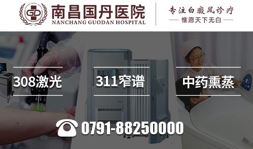南昌国丹医院好吗 都用什么方法治疗白癜风呢