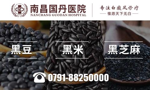 南昌国丹医院教你治疗遗传性白癜风