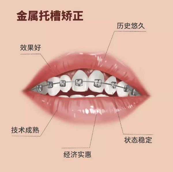 昆明成年人牙齿不齐怎么矫正？德韩口腔为您讲解