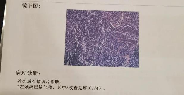 甲状腺癌到底和遗传有没有关系？听听成都民生耳鼻喉专家怎么说