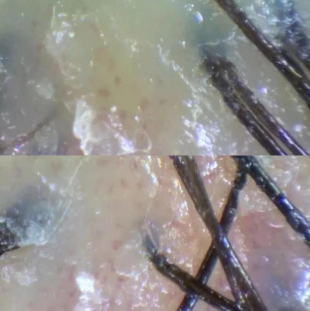 无硅油洗发水中的阳离子大大加重了头皮负担