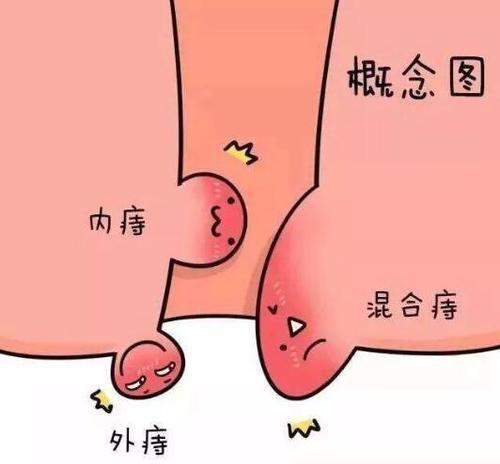 菊花长了个小肉球不痛不痒，这是怎么回事，不治会自己消失吗