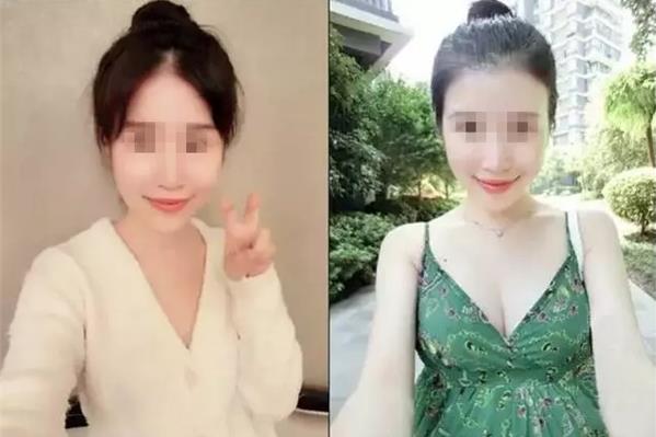 波丽妮雅适合什么人用 波丽妮雅能解决哪些胸部问题